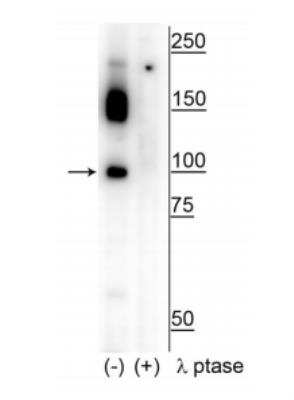 Western Blot: CtIP [p Ser326] Antibody [NBP2-60768]